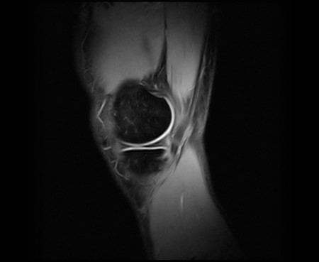 Xbone sagittalis sorozat